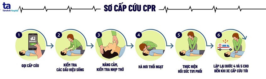 so-cuu-CPR